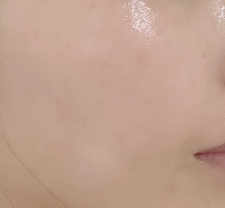After